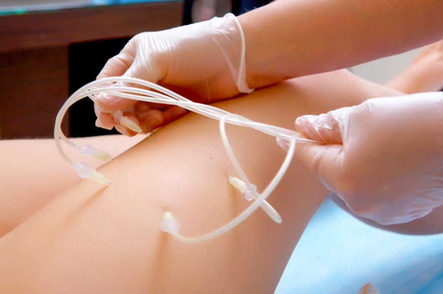 Озонотерапия в санатории «Родник» в Кисловодске - фотография